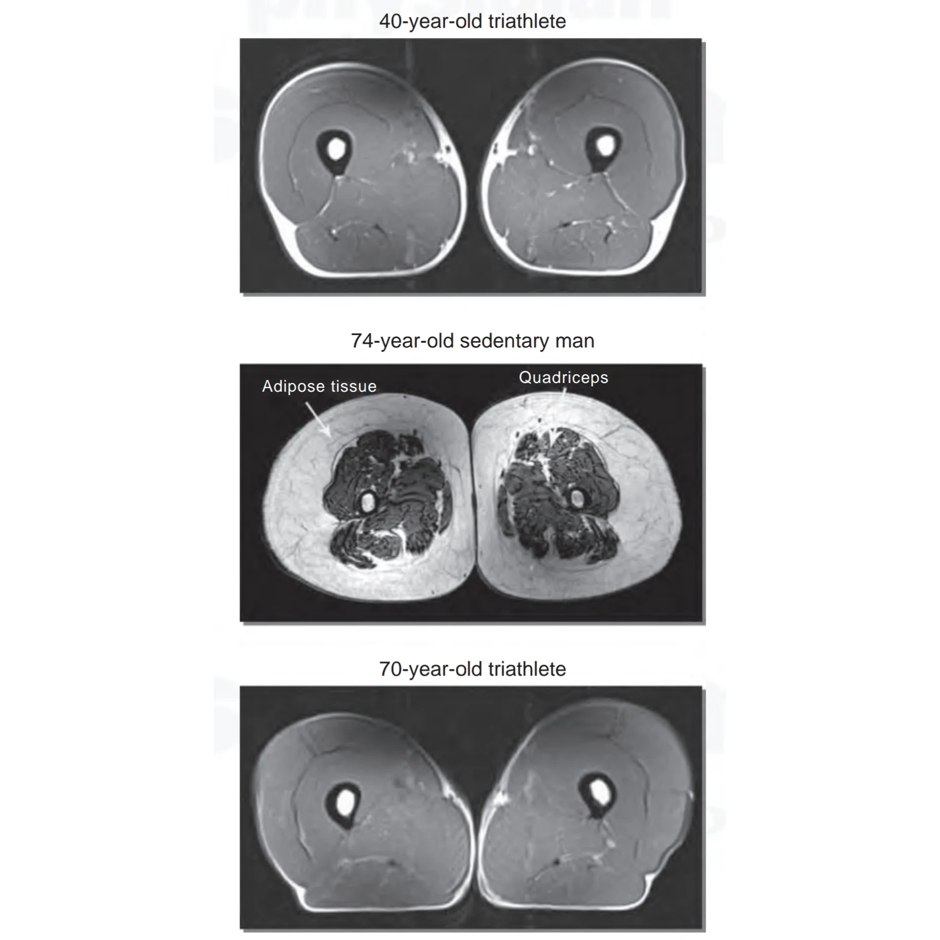 Muskler eldes ikke – hvis du trener. Her er beviset